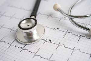 ECG 360º